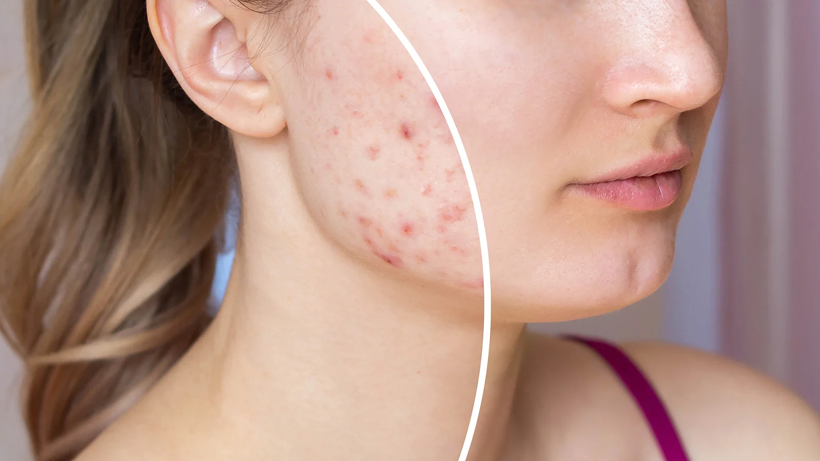 Cosmetic problems