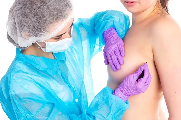 breast-lift